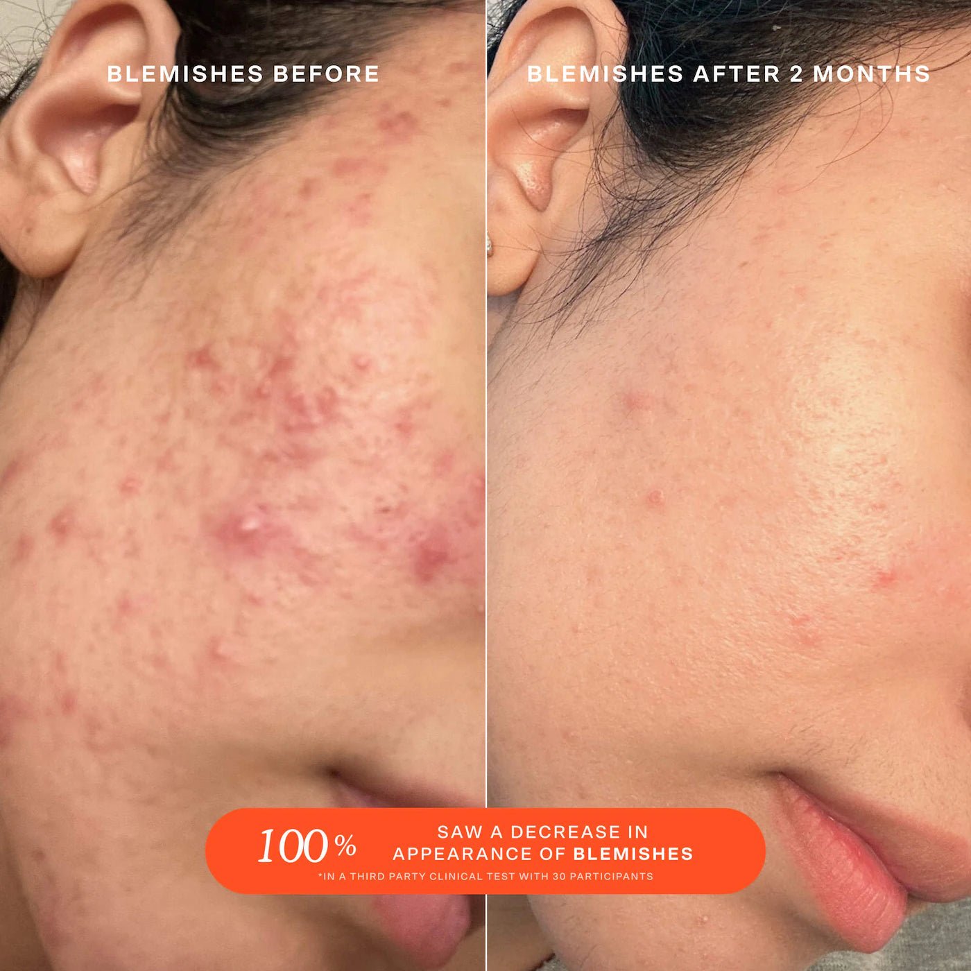 SOS Daily Rescue Facial Spray with Hypochlorous Acid - BELLA NOVA BEAUTY (PTY) LTDSOS Facial SprayTower 28BELLA NOVA BEAUTY (PTY) LTD