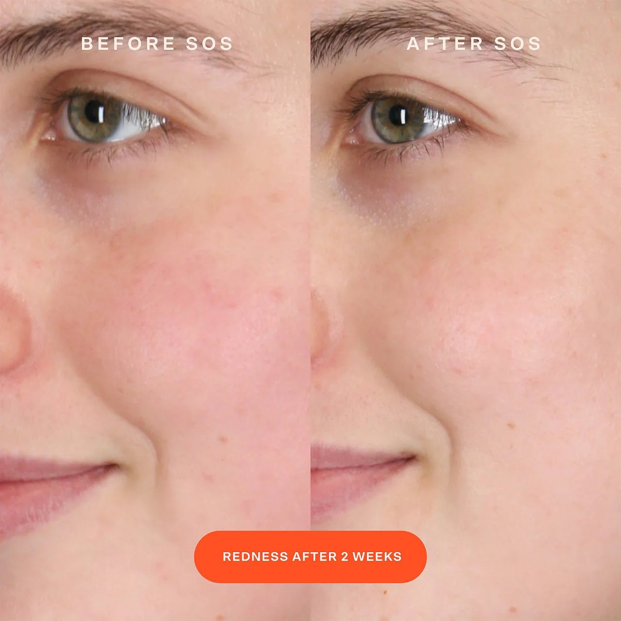 SOS Intensive Redness Relief Serum with Hypochlorous Acid - BELLA NOVA BEAUTY (PTY) LTDSOS Serum - Intense Redness ReliefTower 28BELLA NOVA BEAUTY (PTY) LTD