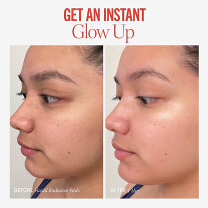 Facial Radiance Pads with Glycolic + Lactic Acids