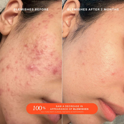 SOS Daily Rescue Facial Spray with Hypochlorous Acid - BELLA NOVA BEAUTY (PTY) LTDSOS Facial SprayTower 28BELLA NOVA BEAUTY (PTY) LTD